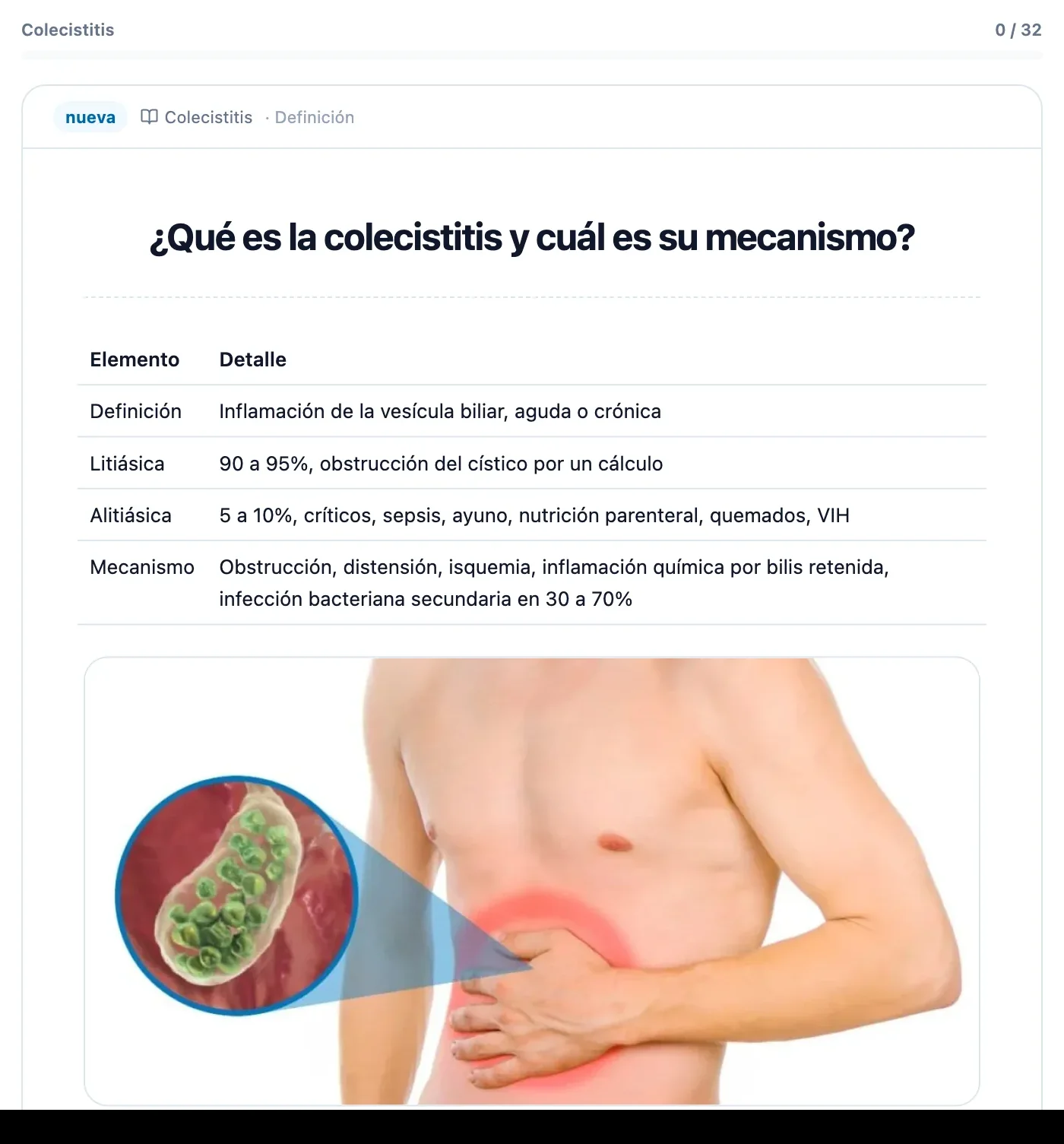Flashcard del artículo de colecistitis: pregunta, respuesta e imagen